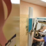 Cáncer de mama en México: qué cambios en tus senos no debes ignorar y dónde revisarte sin costo